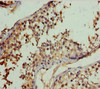Immunohistochemistry of paraffin-embedded human testis tissue using CSB-PA848846DSR1HU at dilution of 1:100