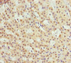 Immunohistochemistry of paraffin-embedded human adrenal gland tissue using CSB-PA848846DSR1HU at dilution of 1:100