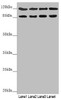 Western blot<br />
 All lanes: SCYL1 antibody at 3.15 µg/ml<br />
 Lane 1: 293T whole cell lysate<br />
 Lane 2: Hela whole cell lysate<br />
 Lane 3: 3T3 whole cell lysate<br />
 Lane 4: A549 whole cell lysate<br />
 Secondary<br />
 Goat polyclonal to rabbit IgG at 1/10000 dilution<br />
 Predicted band size: 90, 89, 79, 87, 70 kDa<br />
 Observed band size: 90, 110 kDa<br />