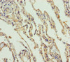 Immunohistochemistry of paraffin-embedded human lung tissue using CSB-PA733714DSR1HU at dilution of 1:100