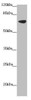 Western blot<br />
 All lanes: SLC34A1 antibody at 2.34 µg/ml + Mouse brain tissue<br />
 Secondary<br />
 Goat polyclonal to rabbit IgG at 1/10000 dilution<br />
 Predicted band size: 69, 37 kDa<br />
 Observed band size: 69 kDa<br />