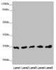 Western blot<br />
 All lanes: EEF1B2 antibody at 0.91 µg/ml<br />
 Lane 1: PC-3 whole cell lysate<br />
 Lane 2: 293T whole cell lysate<br />
 Lane 3: Hela whole cell lysate<br />
 Lane 4: Jurkat whole cell lysate<br />
 Lane 5: Raw264.7 whole cell lysate<br />
 Secondary<br />
 Goat polyclonal to rabbit IgG at 1/10000 dilution<br />
 Predicted band size: 25 kDa<br />
 Observed band size: 25 kDa<br />