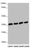 Western blot<br />
 All lanes: ANKRD1 antibody at 1.91µg/ml<br />
 Lane 1: Hela whole cell lysate<br />
 Lane 2: 293T whole cell lysate<br />
 Lane 3: Jurkat whole cell lysate<br />
 Lane 4: HepG2 whole cell lysate<br />
 Secondary<br />
 Goat polyclonal to rabbit IgG at 1/10000 dilution<br />
 Predicted band size: 36 kDa<br />
 Observed band size: 36 kDa<br />