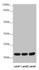 Western blot<br />
 All lanes: MYL3 antibody at 3.78 µg/ml<br />
 Lane 1: Mouse heart tissue<br />
 Lane 2: Mouse skeletal muscle tissue<br />
 Lane 3: Rat heart tissue<br />
 Secondary<br />
 Goat polyclonal to rabbit IgG at 1/10000 dilution<br />
 Predicted band size: 22 kDa<br />
 Observed band size: 22 kDa<br />