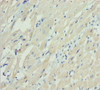 Immunohistochemistry of paraffin-embedded human heart tissue using CSB-PA015310DSR1HU at dilution of 1:100
