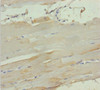 Immunohistochemistry of paraffin-embedded human skeletal muscle tissue using CSB-PA015310DSR2HU at dilution of 1:100