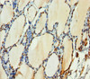Immunohistochemistry of paraffin-embedded human thyroid tissue using CSB-PA010098DSR1HU at dilution of 1:100