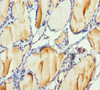 Immunohistochemistry of paraffin-embedded human thyroid tissue using CSB-PA010098DSR2HU at dilution of 1:100