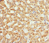 Immunohistochemistry of paraffin-embedded human adrenal gland tissue using CSB-PA889142DSR2HU at dilution of 1:100