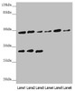 Western blot<br />
 All lanes: BCS1L antibody at 5.04 µg/ml<br />
 Lane 1: Mouse kidney tissue<br />
 Lane 2: Mouse liver tissue<br />
 Lane 3: Mouse brain tissue<br />
 Lane 4: A549 whole cell lysate<br />
 Lane 5: 293T whole cell lysate<br />
 Lane 6: Hela whole cell lysate<br />
 Secondary<br />
 Goat polyclonal to rabbit IgG at 1/10000 dilution<br />
 Predicted band size: 48 kDa<br />
 Observed band size: 48, 30 kDa<br />