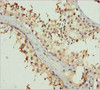 Immunohistochemistry of paraffin-embedded human testis tissue using CSB-PA007791ESR1HU at dilution of 1:100