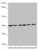 Western blot<br />
 All lanes: ETFA antibody at 4.34µg/ml<br />
 Lane 1: A431 whole cell lysate<br />
 Lane 2: Hela whole cell lysate<br />
 Lane 3: K562 whole cell lysate<br />
 Lane 4: A549 whole cell lysate<br />
 Lane 5: HepG2 whole cell lysate<br />
 Lane 6: MCF-7 whole cell lysate<br />
 Secondary<br />
 Goat polyclonal to rabbit IgG at 1/10000 dilution<br />
 Predicted band size: 36, 31 kDa<br />
 Observed band size: 36 kDa<br />