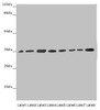 Western blot<br />
 All lanes: ETFA antibody at 2.88µg/ml<br />
 Lane 1: Mouse small intestine tissue<br />
 Lane 2: Mouse liver tissue<br />
 Lane 3: A431 whole cell lysate<br />
 Lane 4: Hela whole cell lysate<br />
 Lane 5: K562 whole cell lysate<br />
 Lane 6: A549 whole cell lysate<br />
 Lane 7: HepG2 whole cell lysate<br />
 Lane 8: MCF-7 whole cell lysate<br />
 Secondary<br />
 Goat polyclonal to rabbit IgG at 1/10000 dilution<br />
 Predicted band size: 36, 31 kDa<br />
 Observed band size: 36 kDa<br />