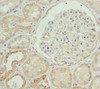 Immunohistochemistry of paraffin-embedded human kidney tissue using CSB-PA007844ESR2HU at dilution of 1:100