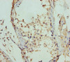 Immunohistochemistry of paraffin-embedded human testis tissue using CSB-PA667562ESR1HU at dilution of 1:100