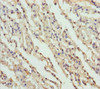 Immunohistochemistry of paraffin-embedded human lung tissue using CSB-PA008751ESR1HU at dilution of 1:100