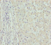 Immunohistochemistry of paraffin-embedded human liver tissue using CSB-PA008751ESR2HU at dilution of 1:100