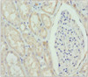 Immunohistochemistry of paraffin-embedded human kidney tissue using CSB-PA009639ESR1HU at dilution of 1:100