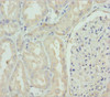 Immunohistochemistry of paraffin-embedded human kidney tissue using CSB-PA009639ESR2HU at dilution of 1:100