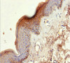 Immunohistochemistry of paraffin-embedded human skin tissue using CSB-PA012561ESR1HU at dilution of 1:100