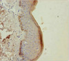 Immunohistochemistry of paraffin-embedded human skin tissue using CSB-PA012561ESR2HU at dilution of 1:100