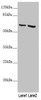 Western blot<br />
 All lanes: KRT6B antibody at 4.29 µg/ml<br />
 Lane 1: A431 whole cell lysate<br />
 Lane 2: A375 whole cell lysate<br />
 Secondary<br />
 Goat polyclonal to rabbit IgG at 1/10000 dilution<br />
 Predicted band size: 60 kDa<br />
 Observed band size: 60 kDa<br />