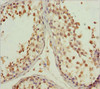 Immunohistochemistry of paraffin-embedded human testis tissue using CSB-PA864008ESR1HU at dilution of 1:100