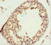 Immunohistochemistry of paraffin-embedded human testis tissue using CSB-PA864008ESR2HU at dilution of 1:100