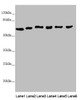 Western blot<br />
 All lanes: MCCC2 antibody at 6.85µg/ml<br />
 Lane 1: Mouse brain tissue<br />
 Lane 2: Hela whole cell lysate<br />
 Lane 3: MCF-7 whole cell lysate<br />
 Lane 4: K562 whole cell lysate<br />
 Lane 5: HepG2 whole cell lysate<br />
 Lane 6: A549 whole cell lysate<br />
 Secondary<br />
 Goat polyclonal to rabbit IgG at 1/10000 dilution<br />
 Predicted band size: 62, 58 kDa<br />
 Observed band size: 62 kDa<br />