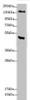 Western blot<br />
 All lanes: MTUS1 antibody at 3.38 µg/ml + Jurkat whole cell lysate<br />
 Secondary<br />
 Goat polyclonal to rabbit IgG at 1/10000 dilution<br />
 Predicted band size: 142, 136, 51, 40, 85, 59, 49 kDa<br />
 Observed band size: 142, 50 kDa<br />