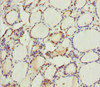 Immunohistochemistry of paraffin-embedded human thyroid tissue using CSB-PA892343DSR2HU at dilution of 1:100