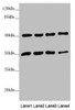 Western blot<br />
 All lanes: MTX1 antibody at 3.78µg/ml<br />
 Lane 1: Jurkat whole cell lysate<br />
 Lane 2: A549 whole cell lysate<br />
 Lane 3: HepG2 whole cell lysate<br />
 Lane 4: MCF-7 whole cell lysate<br />
 Secondary<br />
 Goat polyclonal to rabbit IgG at 1/10000 dilution<br />
 Predicted band size: 52, 48, 36 kDa<br />
 Observed band size: 52, 36 kDa<br />