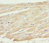Immunohistochemistry of paraffin-embedded human heart tissue using CSB-PA015213ESR1HU at dilution of 1:100