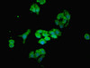 Immunofluorescent analysis of HepG2 cells using CSB-PA015213ESR1HU at dilution of 1:100 and Alexa Fluor 488-congugated AffiniPure Goat Anti-Rabbit IgG (H+L)