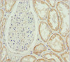 Immunohistochemistry of paraffin-embedded human kidney tissue using CSB-PA015213ESR2HU at dilution of 1:100