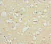 Immunohistochemistry of paraffin-embedded human brain tissue using CSB-PA015510DSR1HU at dilution of 1:100