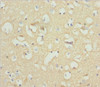 Immunohistochemistry of paraffin-embedded human brain tissue using CSB-PA015510DSR1HU at dilution of 1:100