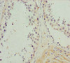 Immunohistochemistry of paraffin-embedded human testis tissue using CSB-PA015510DSR2HU at dilution of 1:100