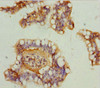 Immunohistochemistry of paraffin-embedded human small intestine tissue using CSB-PA624119ESR1HU at dilution of 1:100