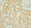 Immunohistochemistry of paraffin-embedded human kidney tissue using CSB-PA880985ESR1HU at dilution of 1:100