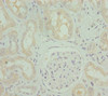 Immunohistochemistry of paraffin-embedded human kidney tissue using CSB-PA880985ESR2HU at dilution of 1:100
