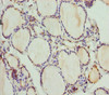 Immunohistochemistry of paraffin-embedded human thyroid tissue using CSB-PA864016DSR1HU at dilution of 1:100