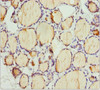 Immunohistochemistry of paraffin-embedded human thyroid tissue using CSB-PA864016DSR2HU at dilution of 1:100