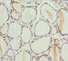 Immunohistochemistry of paraffin-embedded human thyroid tissue using CSB-PA018938ESR1HU at dilution of 1:100