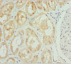 Immunohistochemistry of paraffin-embedded human kidney tissue using CSB-PA018938ESR1HU at dilution of 1:100