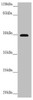 Western blot<br />
 All lanes: PSTPIP1 antibody at 3.99 µg/ml + Raw264.7 whole cell lysate<br />
 Secondary<br />
 Goat polyclonal to rabbit IgG at 1/10000 dilution<br />
 Predicted band size: 48, 46 kDa<br />
 Observed band size: 48 kDa<br />