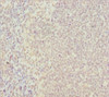 Immunohistochemistry of paraffin-embedded human tonsil tissue using CSB-PA018944ESR2HU at dilution of 1:100