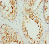 Immunohistochemistry of paraffin-embedded human testis tissue using CSB-PA621768ESR1HU at dilution of 1:100