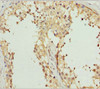Immunohistochemistry of paraffin-embedded human testis tissue using CSB-PA862045DSR1HU at dilution of 1:100