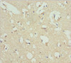 Immunohistochemistry of paraffin-embedded human brain tissue using CSB-PA862045DSR1HU at dilution of 1:100